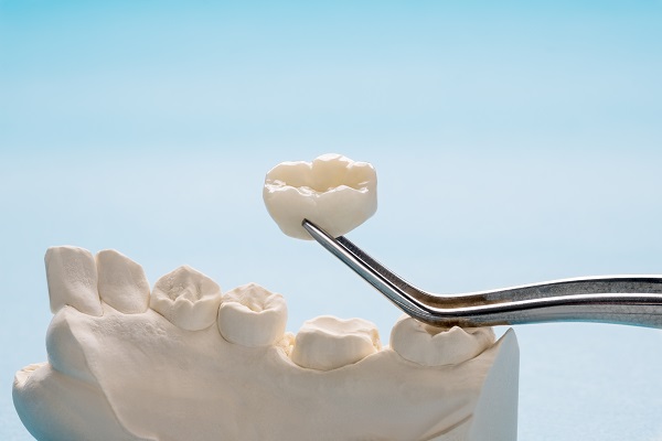 How A Dental Crown Can Improve Your Smile